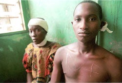 Charles Taylor is charged with war crimes and crimes against humanity for supporting Sierra Leonean rebel forces that committed numerous abuses against civilians during the civil war. Here, a young man waits for medical attention after rebels from the Revolutionary United Front used a knife to mark both his chest and back with the initials RUF. &copy; 1999 Corinne Dufka/Human Rights Watch 