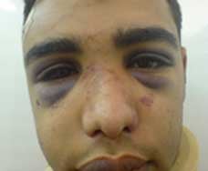علي سعيد الخباز إثر احتجازه من جانب الشرطة البحرينية  2007 خاصة