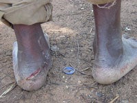 © 2006 HRW