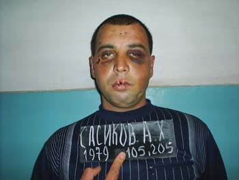 Все фотографии сделаны в период содержания под стражей, получены Хьюман Райтс Вотч от родственников. � Private 2005.