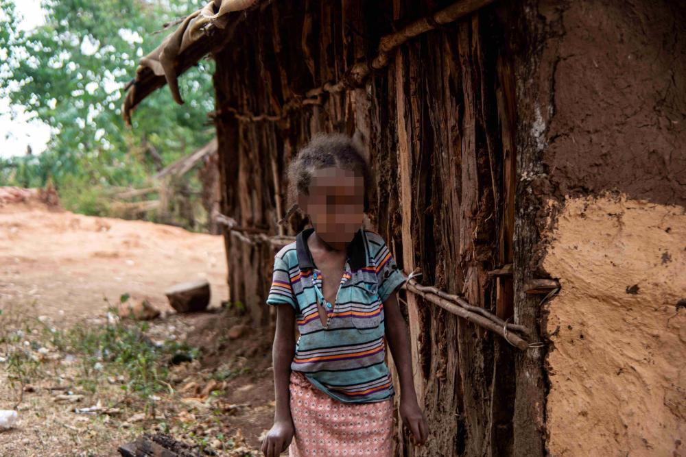 Ein 7-jähriges Mädchen mit einer körperlichen Behinderung in der Nähe der Goldmine Lega Dembi, Region Oromia, Äthiopien. ©2020 Tom Gardner