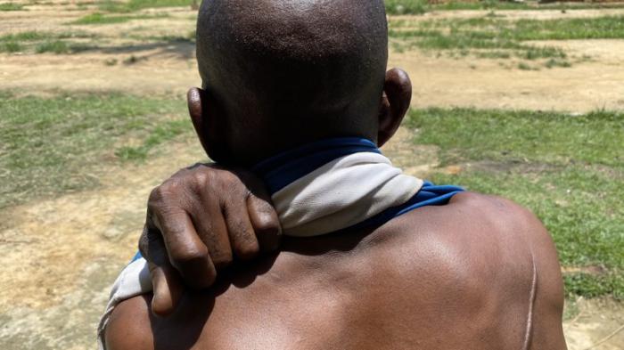 An Indigenous Iyeke man shows a scar from a machete wound in Sambwakoy, Tshuapa province, Democratic Republic of Congo, October 2021. 