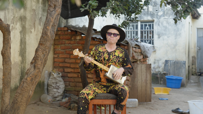 A musician with albinism sits holding a guitar