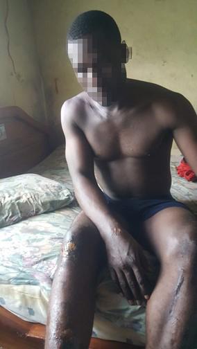 Rape Cute Gand Xxx - How Can You Throw Us Back?â€: Asylum Seekers Abused in the US and Deported  to Harm in Cameroon | HRW