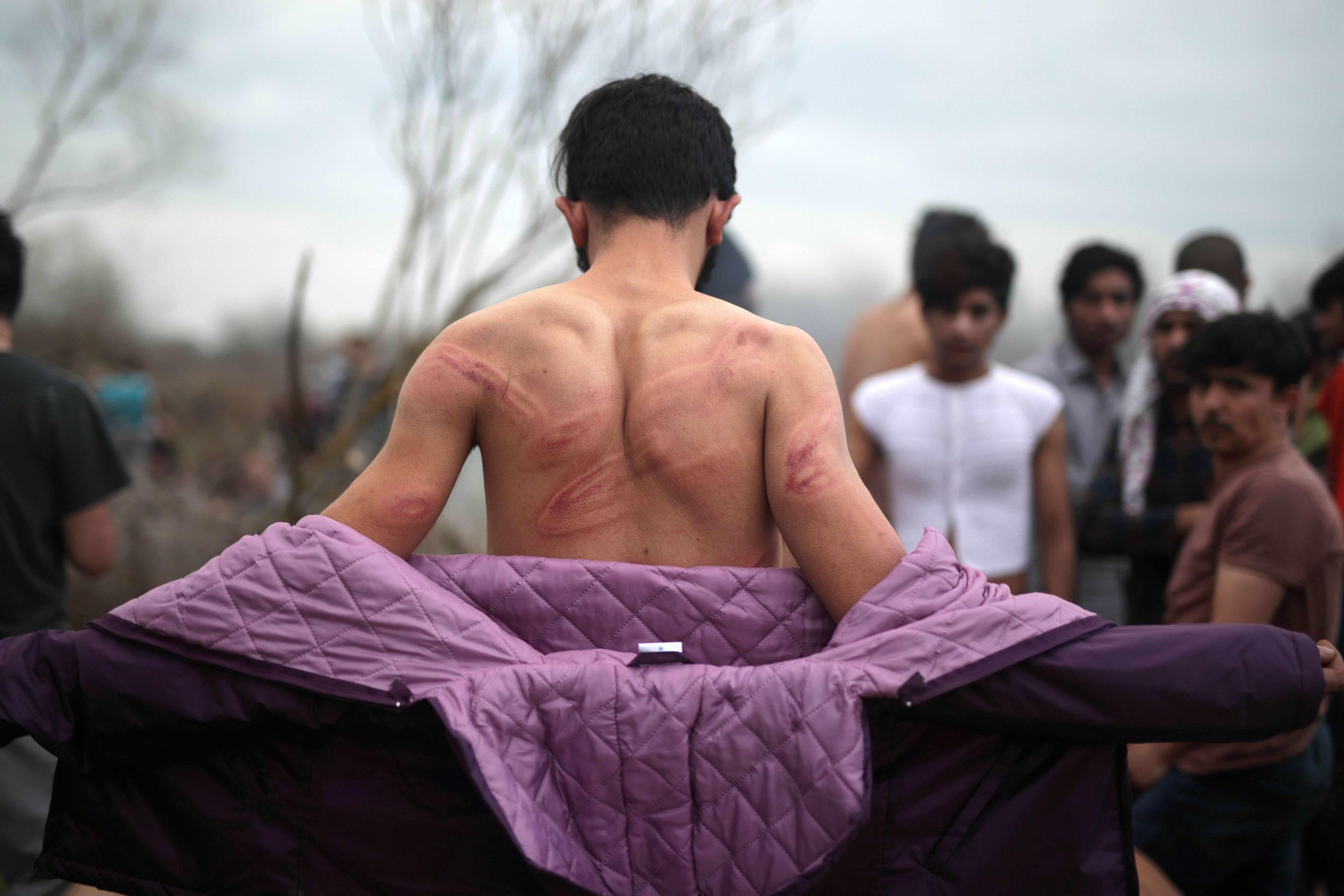 Ελλάδα: Βία κατά των αιτούντων άσυλο στα σύνορα | Human Rights Watch